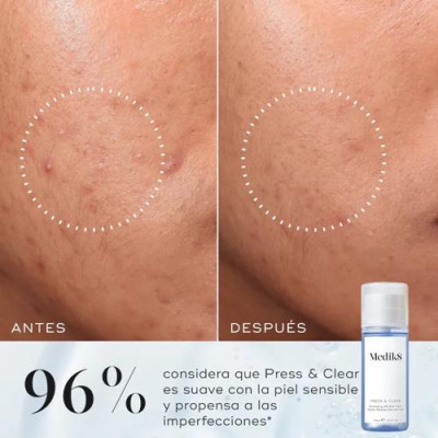 Medik8 Press & Clear 150ml: Tónico BHA para piel más clara